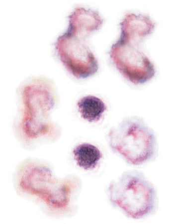 SET DE CONTUSIONES 2 (*Hoja profesional)